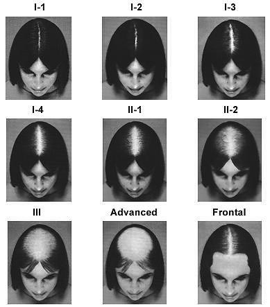 World Hair Research Hair Scales Charts